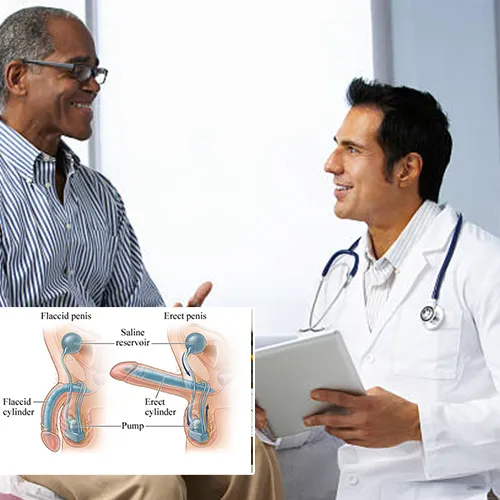 Understanding Penile Implant Brand Reviews: The Importance of Patient Feedback