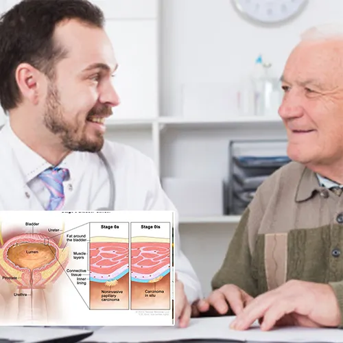 Understanding Penile Implants: Empowering Informed Choices